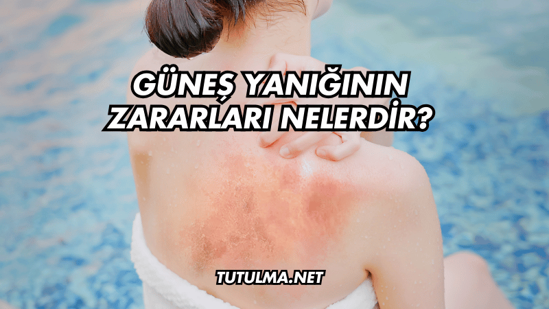 Güneş Yanığının Zararları Nelerdir?
