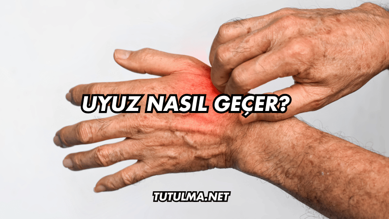 Uyuz Nasıl Geçer?