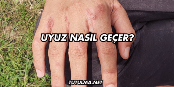 Uyuz Nasıl Geçer?